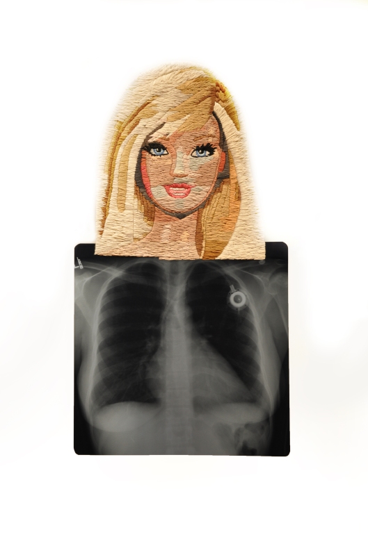 Pacemaker Barbie by Matthew Cox